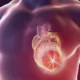 Vaping Reduce Risk of Heart Disease