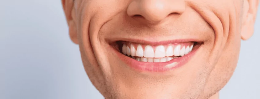 Whiter Teeth and Improved Oral Health