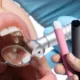Vaping After Tooth Extraction