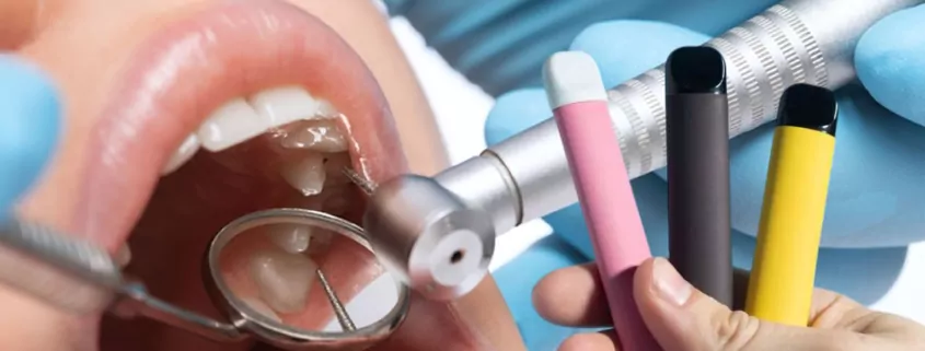 Vaping After Tooth Extraction